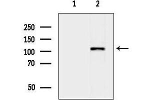 Western blot analysis of lysates from HepG2 cells(heat-shock treatment), using SMARC Antibody.
