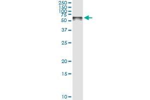 Immunoprecipitation of STIP1 transfected lysate using anti-STIP1 monoclonal antibody and Protein A Magnetic Bead , and immunoblotted with STIP1 MaxPab rabbit polyclonal antibody. (STIP1 抗体  (AA 1-543))
