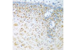 Immunohistochemistry of paraffin-embedded human esophagus using FDXR antibody (ABIN5972045) at dilution of 1/100 (40x lens). (Ferredoxin Reductase 抗体)