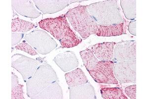 Immunohistochemistry (IHC) image for anti-Protein tyrosine Phosphatase, Receptor Type, A (PTPRA) (Extracellular Domain) antibody (ABIN1049272)
