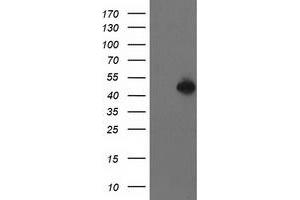 Western Blotting (WB) image for anti-Pre-B-Cell Leukemia Homeobox Protein 1 (PBX1) antibody (ABIN1500046) (PBX1 抗体)