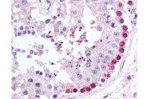 Anti-PINK1 antibody IHC of human testis. (PINK1 抗体  (AA 484-504))