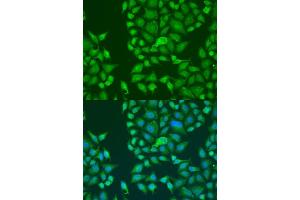 Immunofluorescence analysis of U2OS cells using ST antibody  at dilution of 1:100. (Double-stranded RNA-binding protein Staufen homolog 2 (STAU2) (AA 300-400) 抗体)