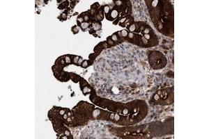 Immunohistochemical staining of human colon with GARNL4 polyclonal antibody  shows strong cytoplasmic, membranous and nuclear positivity in glandular cells at 1:50-1:200 dilution. (RAP1GAP2 抗体)