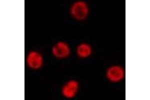 ABIN6277190 staining HepG2 by IF/ICC. (USP7 抗体  (Internal Region))