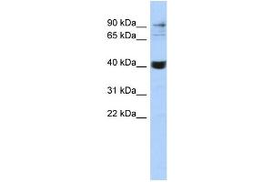 WB Suggested Anti-MMP3 Antibody Titration:  0. (MMP3 抗体  (Middle Region))