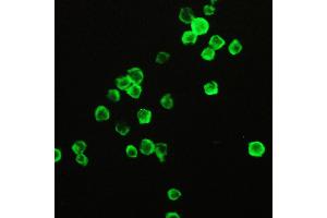 Immunohistochemistry (IHC) image for anti-Peptidylprolyl Isomerase A (Cyclophilin A) (PPIA) (AA 116-165) antibody (ABIN5518864)