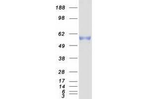 Western Blotting (WB) image for Protein Kinase, Membrane Associated tyrosine/threonine 1 (PKMYT1) (Transcript Variant 1) protein (Myc-DYKDDDDK Tag) (ABIN2729065)