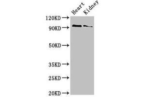 Western Blot Positive WB detected in: Mouse heart tissue, Mouse kidney tissue All lanes: VPS39 antibody at 3 μg/mL Secondary Goat polyclonal to rabbit IgG at 1/50000 dilution Predicted band size: 102, 101 kDa Observed band size: 102 kDa (VPS39 抗体  (AA 263-490))