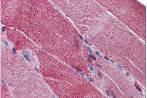 Immunohistochemistry (IHC) image for anti-Proprotein Convertase Subtilisin/kexin Type 6 (PCSK6) (Internal Region) antibody (ABIN308447)