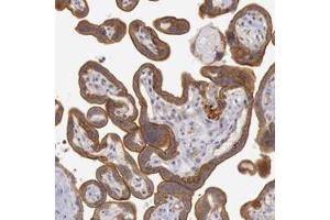 Immunohistochemistry (Formalin/PFA-fixed paraffin-embedded sections) of human placenta with AMOTL1 polyclonal antibody  shows strong cytoplasmic and membranous positivity in trophoblastic cells.
