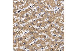 Immunohistochemistry of paraffin-embedded human liver using GFR Rabbit pAb (ABIN6127950, ABIN6141065, ABIN6141066 and ABIN6221017) at dilution of 1:100 (40x lens). (GFRA1 抗体  (AA 25-280))