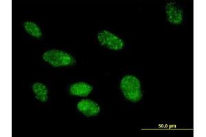 Immunofluorescence of purified MaxPab antibody to FKBP3 on HeLa cell. (FKBP3 抗体  (AA 1-224))
