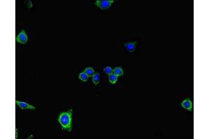 Immunofluorescent analysis of HepG2 cells using ABIN7150877 at dilution of 1:100 and Alexa Fluor 488-congugated AffiniPure Goat Anti-Rabbit IgG(H+L) (DNAH7 抗体  (AA 730-903))