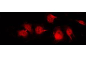 Immunofluorescence (fixed cells) (IF/ICC) image for anti-Solute Carrier Family 2 (Facilitated Glucose Transporter), Member 1 (SLC2A1) (C-Term) antibody (ABIN6261995)