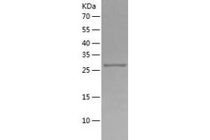 Western Blotting (WB) image for Secreted Protein, Acidic, Cysteine-Rich (Osteonectin) (SPARC) (AA 18-297) protein (His tag) (ABIN7125003)