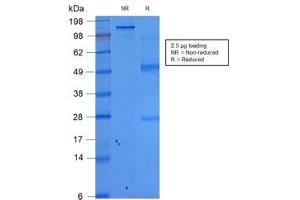 SDS-PAGE (SDS) image for anti-Epithelial Cell Adhesion Molecule (EPCAM) (AA 77-202), (Extracellular Domain) antibody (ABIN5707561)
