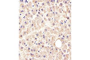 Immunohistochemical analysis of paraffin-embedded H. (c-MET 抗体  (Catalytic Domain))