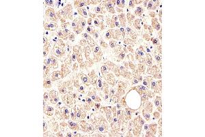 Immunohistochemical analysis of paraffin-embedded H. (c-MET 抗体  (Catalytic Domain))