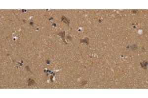 Immunohistochemistry of paraffin-embedded Human brain using PUS10 Polyclonal Antibody at dilution of 1:45 (PUS10 抗体)