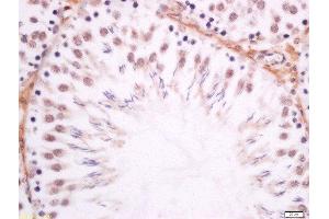 Paraformaldehyde-fixed, paraffin embedded rat testis tissue, Antigen retrieval by boiling in sodium citrate buffer(pH6) for 15min, Block endogenous peroxidase by 3% hydrogen peroxide for 30 minutes, Blocking buffer (normal goat serum) at 37°C for 20min, Antibody incubation with Rabbit Anti-DMO/Dmrt1a Polyclonal Antibody, Unconjugated  at 1:200 overnight at 4°C, followed by a conjugated secondary and DAB staining (DMO/Dmrt1a (AA 51-100) 抗体)