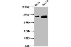 Western Blot Positive WB detected in: Hela whole cell lysate, HepG2 whole cell lysate All lanes: TMF1 antibody at 3. (TMF1 抗体  (AA 878-986))