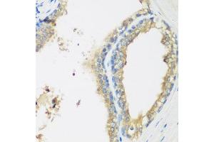 Immunohistochemistry of paraffin-embedded human prostate using WDR77 antibody at dilution of 1:200 (40x lens). (WDR77 抗体)