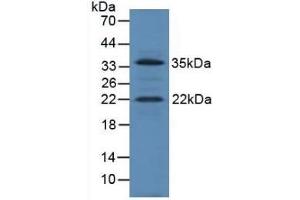 Detection of IGF1 in Mouse Heart Tissue using Polyclonal Antibody to Insulin Like Growth Factor 1 (IGF1) (IGF1 抗体  (AA 49-153))
