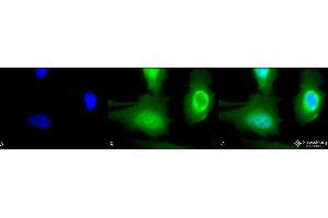 Immunocytochemistry/Immunofluorescence analysis using Rabbit Anti-Calreticulin Polyclonal Antibody . (Calreticulin 抗体  (HRP))