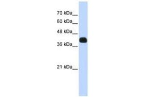 Image no. 1 for anti-ISL LIM Homeobox 2 (ISL2) (N-Term) antibody (ABIN6740633) (ISL2 抗体  (N-Term))