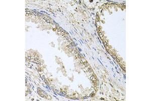 Immunohistochemistry of paraffin-embedded human prostate using CYP46A1 antibody at dilution of 1:100 (x40 lens). (CYP46A1 抗体)