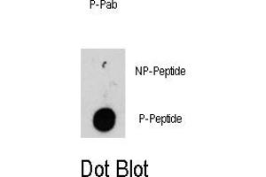 Image no. 1 for anti-Integrin-Linked Kinase (ILK) (pThr173) antibody (ABIN358419) (ILK 抗体  (pThr173))