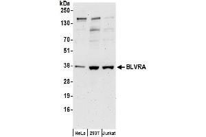 anti-Biliverdin Reductase A (BLVRA) (AA 75-125) antibody