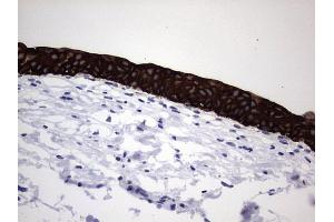 Immunohistochemistry (IHC) image for anti-Keratin Acidic (AE1) antibody (ABIN2715666) (Keratin Acidic (AE1) 抗体)