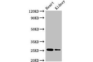 Western Blot Positive WB detected in: Mouse heart tissue, Mouse kidney tissue All lanes: CSH2 antibody at 4 μg/mL Secondary Goat polyclonal to rabbit IgG at 1/50000 dilution Predicted band size: 25, 19, 14 kDa Observed band size: 25 kDa (CSH1 抗体  (AA 27-217))
