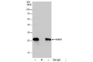 IP Image Immunoprecipitation of HSP27 protein from HeLa whole cell extracts using 5 μg of HSP27 antibody, Western blot analysis was performed using HSP27 antibody, EasyBlot anti-Rabbit IgG  was used as a secondary reagent. (HSP27 抗体  (Center))