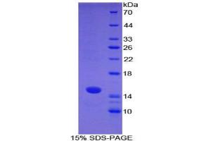 SDS-PAGE analysis of Mouse S100A7 Protein. (S100A7 蛋白)
