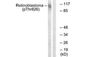 Western blot analysis of extracts from HepG2 cells treated with nocodazole 1ug/ml 16h, using Retinoblastoma (Phospho-Thr826) Antibody. (Retinoblastoma Protein (Rb) 抗体  (pThr826))