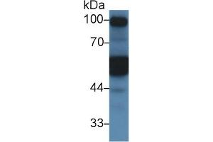 Detection of a1AT in Mouse Kidney lysate using Polyclonal Antibody to Alpha-1-Antitrypsin (a1AT) (SERPINA1 抗体  (AA 25-413))