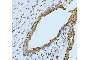 IHC analysis of SBNO1 using anti-SBNO1 antibody (ABIN7601710). (SBNO1 抗体  (AA 43-1303))