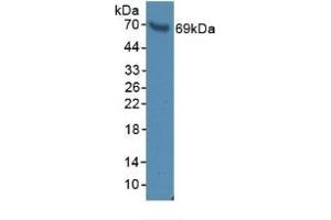 Detection of BFP in Rat Serum using Polyclonal Antibody to Brain Finger Protein (BFP) (RNF112 抗体  (AA 256-504))