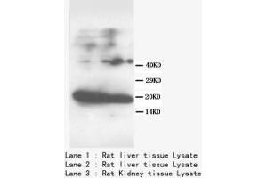 Image no. 2 for anti-Fatty Acid Binding Protein 1, Liver (FABP1) (N-Term) antibody (ABIN1495134) (FABP1 抗体  (N-Term))