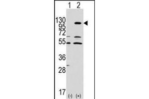 Western blot analysis of EphA7 (arrow) using rabbit polyclonal EphA7 Antibody (ABIN391900 and ABIN2841718). (EPH Receptor A7 抗体)