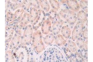 Detection of Slit1 in Rat Kidney Tissue using Polyclonal Antibody to Slit Homolog 1 (Slit1)