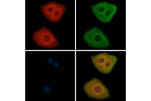 ABIN6264912 and ABIN6269293 staining Hela cells by IF/ICC. (RPS6 抗体  (C-Term))