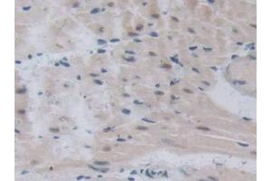 Detection of TCF20 in Mouse Cardiac Muscle Tissue using Polyclonal Antibody to Transcription factor 20 (TCF20)