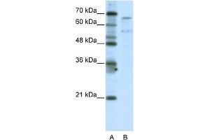 WB Suggested Anti-TAF6L Antibody Titration:  5. (TAF6L 抗体  (N-Term))