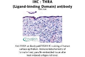 Image no. 1 for anti-Thyroid Hormone Receptor, alpha (THRA) antibody (ABIN1740044) (THRA 抗体)