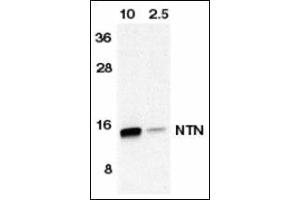 Western blot analysis of NTN in HeLa cell lyaste containing 10 or 2. (Neurturin 抗体  (AA 178-193))