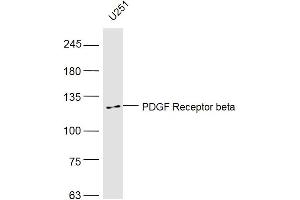U251 lysates probed with PDGF Receptor beta Polyclonal Antibody, Unconjugated  at 1:500 dilution and 4˚C overnight incubation. (PDGFRB 抗体  (AA 981-1066))
